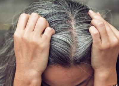 آیا استرس واقعا عامل سفیدشدن مو است؟ آیا استرس واقعا عامل سفیدشدن مو است؟